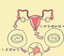 北京三代试管婴儿价格解读为啥不一样？